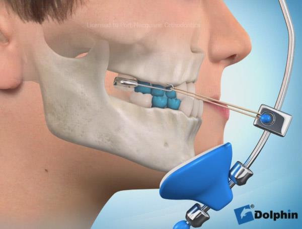 osnovna-klasifikacija-griza